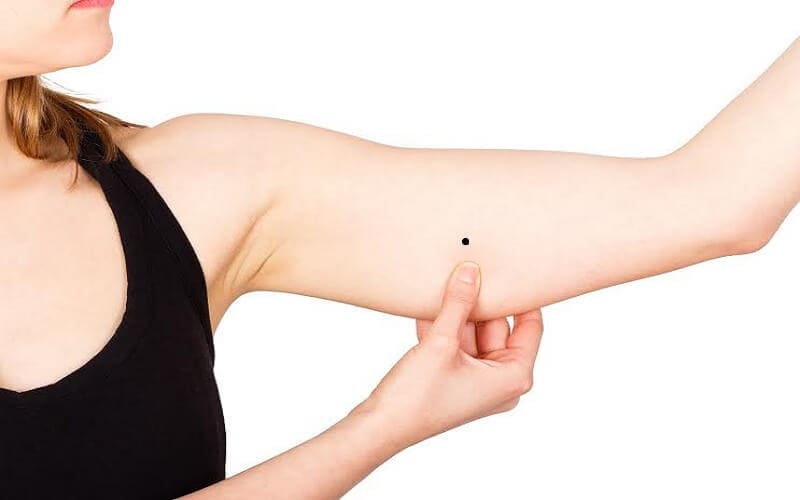nốt ruồi ở cánh tay trái của phụ nữ