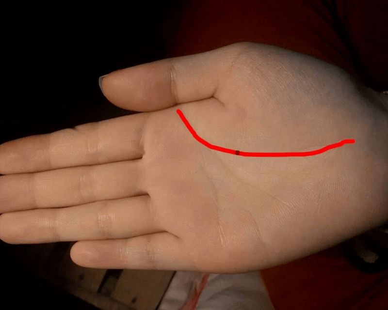 ý nghĩa vị trí nốt ruồi trong lòng bàn tay